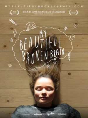 Xem Phim Khối Óc Xinh Đẹp Tội Nghiệp Của Tôi Online